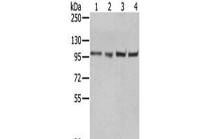 Western Blot analysis of A431, 293T, Hela and K562 cells using TPX2 Polyclonal Antibody at dilution of 1/800 (TPX2 anticorps)