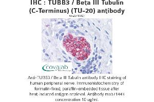 Image no. 1 for anti-Tubulin, beta 3 (TUBB3) (N-Term) antibody (ABIN1724161)