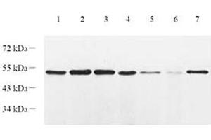 Western blot analysis of EIF2S2 (ABIN7073880) at dilution of 1: 1000,Lane 1: HT29 cell lysate,Lane 2: L1299 cell lysate,Lane 3: CaCO2 cell lysate,Lane 4: Mouse lung tissue lysate,Lane 5: Mouse colon tissue lysate,Lane 6: Mouse small intestine tissue lysate,Lane 7: Rat lung tissue lysate