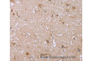 Immunohistochemistry of Human brain  using FHL2 Polyclonal Antibody at dilution of 1:40 (FHL2 anticorps)