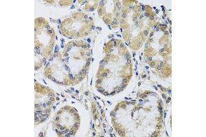 Immunohistochemistry of paraffin-embedded Human stomach using MRPL1 Polyclonal Antibody at dilution of 1:100 (40x lens).
