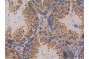 DAB staining on IHC-P; Samples: Mouse Testis Tissue