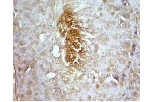 Rat testis tissue was stained by rabbit Anti-Desnutrin (296-318) (Mouse) Serum