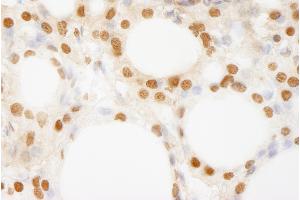 Immunohistochemistry (IHC) image for anti-BRF1, RNA polymerase III transcription initiation factor subunit (BRF1) (AA 627-677) antibody (ABIN7454729)