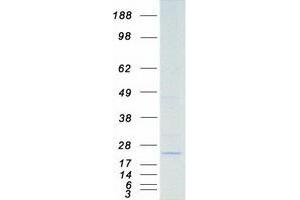 Validation with Western Blot