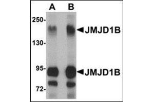 Western blot analysis of JMJD1B in rat liver tissue lysate with this product at (A) 1 and (B) 2 μg/ml. (KDM3B anticorps  (Center))