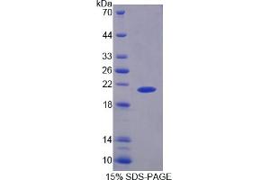 SDS-PAGE of Protein Standard from the Kit (Highly purified E.