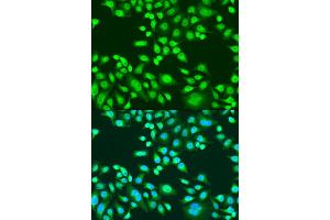 Immunofluorescence analysis of U2OS cells using PAX8 antibody (ABIN1874050) at dilution of 1:100.