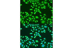 Immunofluorescence analysis of U2OS cells using PAX8 antibody (ABIN1874050) at dilution of 1:100. (PAX8 anticorps)