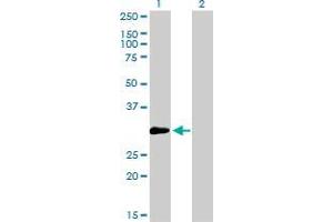 Western Blot analysis of ZNF174 expression in transfected 293T cell line by ZNF174 monoclonal antibody (M01), clone 2D7-E9.