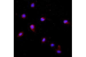 IF analysis of Krt20 using anti-Krt20 antibody (ABIN7601133). (KRT20 anticorps  (AA 29-431))