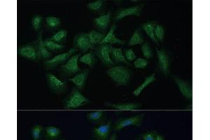 Immunofluorescence analysis of U-2 OS cells using REXO2 Polyclonal Antibody at dilution of 1:100 (40x lens). (REXO2 anticorps)
