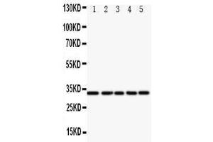 Western Blotting (WB) image for anti-E2F Transcription Factor 6 (E2F6) (AA 162-177), (Middle Region) antibody (ABIN3044189) (E2F6 anticorps  (Middle Region))