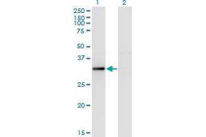 Western Blot analysis of RYBP expression in transfected 293T cell line by RYBP monoclonal antibody (M08), clone 1F4.