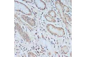 Immunohistochemistry of paraffin-embedded human stomach using TCEB2 antibody (ABIN6131621, ABIN6148934, ABIN6148936 and ABIN6217328) at dilution of 1:100 (40x lens). (TCEB2 anticorps  (AA 1-118))