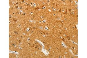 Immunohistochemistry (IHC) image for anti-Solute Carrier Family 18 (Vesicular Monoamine Transporter), Member 2 (SLC18A2) antibody (ABIN3016723)