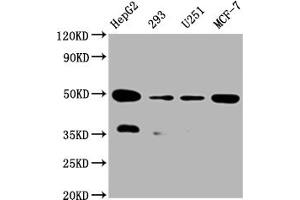 Western Blot Positive WB detected in:HepG2 whole cell lysate, 293 whole cell lysate, U251 whole cell lysate, MCF-7 whole cell lysate All lanes: UQCRC2 antibody at 1:2000 Secondary Goat polyclonal to rabbit IgG at 1/50000 dilution Predicted band size: 49 kDa Observed band size: 49 kDa (Recombinant UQCRC2 anticorps)