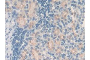 IHC-P analysis of Rat Kidney Tissue, with DAB staining. (MT2 anticorps  (AA 1-61))