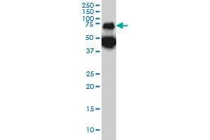 TPP1 monoclonal antibody (M01), clone 3B1 Western Blot analysis of TPP1 expression in A-431 . (TPP1 anticorps  (AA 195-304))