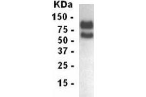 Western Blotting (WB) image for anti-Low Density Lipoprotein Receptor (LDLR) (AA 29-205) antibody (ABIN2467854) (LDLR anticorps  (AA 29-205))