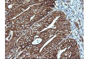 Image no. 2 for anti-Mitogen-Activated Protein Kinase Kinase 1 (MAP2K1) antibody (ABIN1499375)