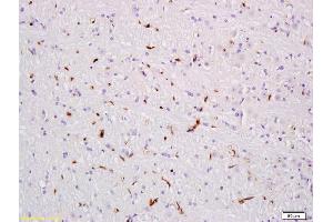 Formalin-fixed and paraffin embedded rat brain tissue labeled with Anti VEGF Polyclonal Antibody,Unconjugated (ABIN674829) at 1:300 followed by conjugation to the secondary antibody and DAB staining. (VEGF anticorps)