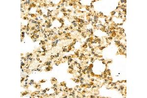 Immunohistochemistry of paraffin embedded mouse lung using PTPN12 (ABIN7075292) at dilution of 1: 2500 (400x lens)