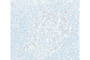 Immunohistochemistry (IHC) image for anti-Enhancer of Zeste Homolog 2 (EZH2) (AA 1-154) antibody (ABIN7795766) (Recombinant EZH2 anticorps  (AA 1-154))