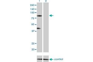 Western blot analysis of RNF103 over-expressed 293 cell line, cotransfected with RNF103 Validated Chimera RNAi (Lane 2) or non-transfected control (Lane 1). (RNF103 anticorps  (AA 501-599))