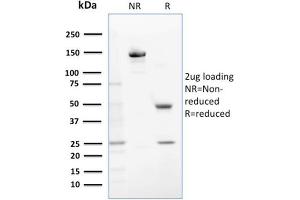 SDS-PAGE Analysis Purified GSTM1 Mouse Monoclonal Antibody (GSTMu1-3).