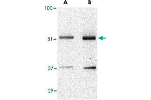 Western blot analysis of TANK in Daudi cell lysate with TANK polyclonal antibody  at (A) 0. (TANK anticorps  (N-Term))