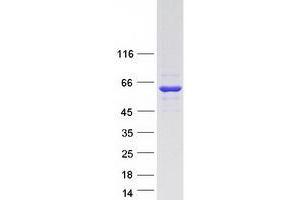Validation with Western Blot