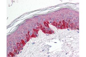 Anti-STK11 / LKB1 antibody IHC of human skin.