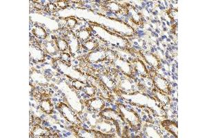 Immunohistochemistry of paraffin embedded rat kidney using HSP60 (ABIN7074167) at dilution of 1: 1500 (300x lens)
