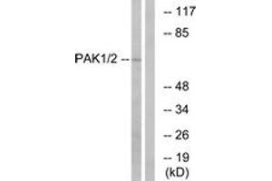 Western blot analysis of extracts from K562 cells, using PAK1/2 (Ab-199) Antibody. (PAK1/2 anticorps  (AA 165-214))