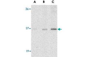 Western blot analysis of C1QTNF7 in NIH/3T3 cell lysate with C1QTNF7 polyclonal antibody  at (A) 1, (B) 2, and (C) 4 ug/mL . (CTRP7 anticorps  (N-Term))