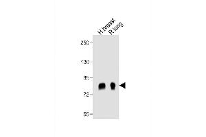 All lanes : Anti- POSTN Antibody (C-term) at 1:1000 dilution Lane 1: human breast lysate Lane 2: rat lung lysate Lysates/proteins at 20 μg per lane. (Periostin anticorps  (C-Term))