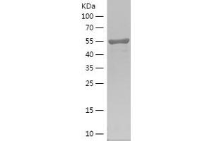 Western Blotting (WB) image for Phosphatidylinositol-5-Phosphate 4-Kinase, Type II, alpha (PIP4K2A) (AA 208-406) protein (His-IF2DI Tag) (ABIN7124405)