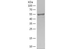 Western Blotting (WB) image for Phosphatidylinositol-5-Phosphate 4-Kinase, Type II, alpha (PIP4K2A) (AA 208-406) protein (His-IF2DI Tag) (ABIN7124405) (PIP4K2A Protein (AA 208-406) (His-IF2DI Tag))