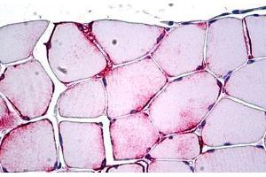 Human Skeletal Muscle: Formalin-Fixed, Paraffin-Embedded (FFPE) (PPP1R13L anticorps  (AA 75-125))