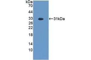 Detection of Recombinant EXO1, Mouse using Polyclonal Antibody to Exonuclease 1 (EXO1) (Exonuclease 1 anticorps  (AA 1-250))