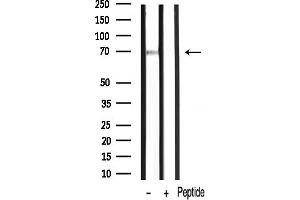 anti-Protein Kinase C, zeta (PRKCZ) (pThr410) antibody
