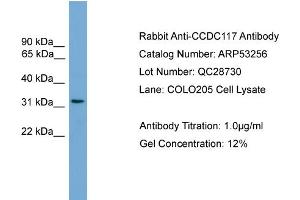 WB Suggested Anti-CCDC117  Antibody Titration: 0. (CCDC117 anticorps  (Middle Region))