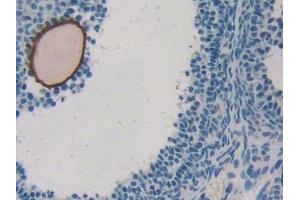 Used in DAB staining on fromalin fixed paraffin- embedded liver tissue