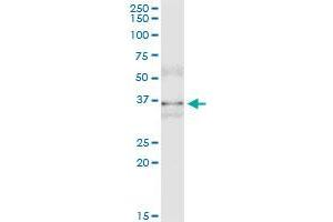 Immunoprecipitation of MSI2 transfected lysate using anti-MSI2 monoclonal antibody and Protein A Magnetic Bead , and immunoblotted with MSI2 monoclonal antibody.