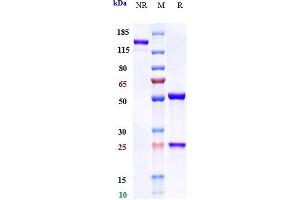 Anti-IL-6 / IFNb2 Reference Antibody (olokizumab) on SDS-PAGE under reducing (R) condition. (Recombinant IL6 (Olokizumab Biosimilar) anticorps)