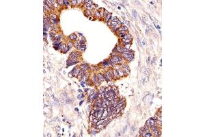 Immunohistochemical analysis of paraffin-embedded H. (PCSK9 anticorps  (N-Term))