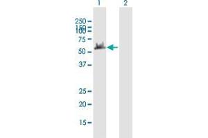 Western Blot analysis of DYNC1LI2 expression in transfected 293T cell line by DYNC1LI2 MaxPab polyclonal antibody.