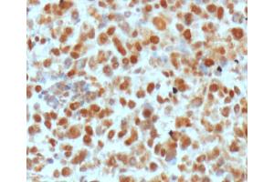 Image no. 3 for anti-DNA Repair Protein Apurinic Endonuclease antibody (ABIN5693483) (DNA Repair Protein Apurinic Endonuclease anticorps)