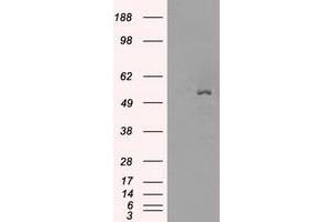 Image no. 4 for anti-Solute Carrier Family 2 (Facilitated Glucose/fructose Transporter), Member 5 (SLC2A5) antibody (ABIN1498477) (SLC2A5 anticorps)